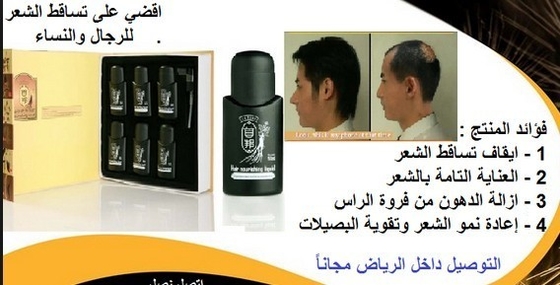 Perte des cheveux de traitement de perte des cheveux de greffe de cheveux de traitement de perte des cheveux chez les femmes 6 * 50ml