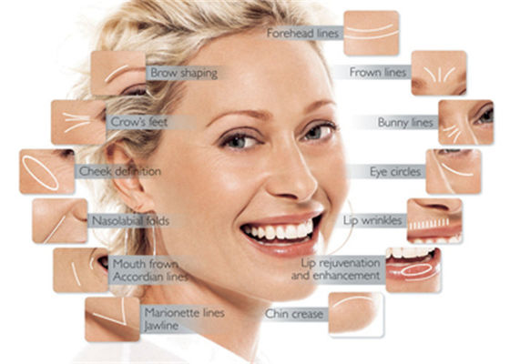 Visage cutané actuel durable d'injections d'acide hyaluronique de collagène de remplisseur