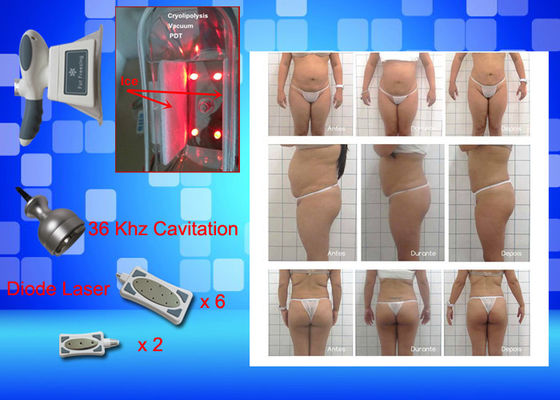 Cryo gelant le poids d'équipement de laser Lipo perdent la machine à la maison de beauté