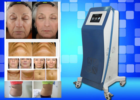 Cryo gelant le poids d'équipement de laser Lipo perdent la machine à la maison de beauté